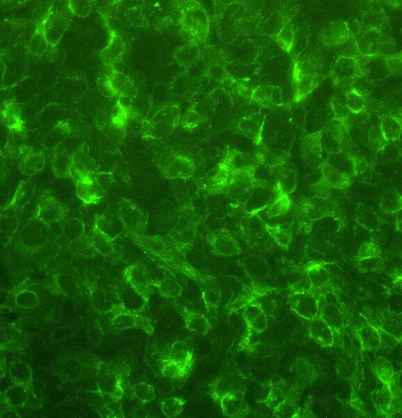 IF of A-431 cells labeled with DSHB antibody DSHB-GFP-12E6 against green fluorescent protein (GFP). Image credit: Soll Laboratory, University of Iowa. 